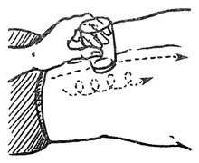 Баночний масаж (масаж льодом - кріомасаж)