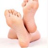 Догляд за ногами взимку: суха шкіра, пітливість ніг, варикозне розширення вен