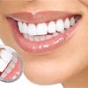 Карієс зубів: профілактика та лікування в домашніх умовах