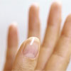 Хвороби і захворювання нігтів рук і ніг. Лікування і запобігання хвороб нігтів рук та ніг