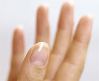 Хвороби і захворювання нігтів рук і ніг. Лікування і запобігання хвороб нігтів рук та ніг
