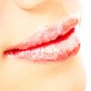 Лущення губ: причини, лікування і народні засоби